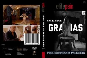 PINK BRUISES ON PALE SKIN (ELITE PAIN)