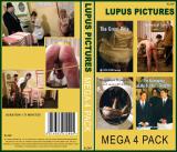 LUPUS MEGA 4 PACK (4DVDS)